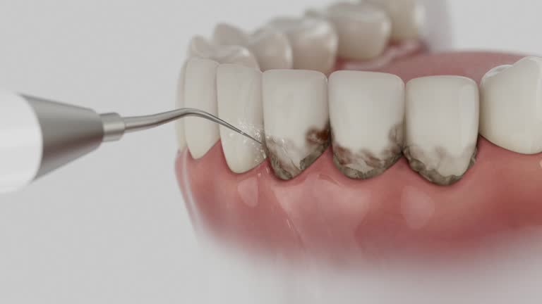 Trusted Dental Crowns And Bridges service in Jacksboro, TX - Dentist Open Now